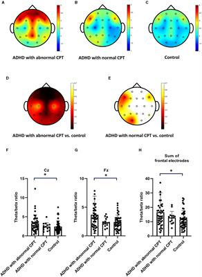 Theta/beta ratio in EEG correlated with attentional capacity assessed by Conners Continuous Performance Test in children with ADHD